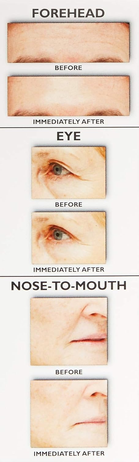 Temporary Face Tightener