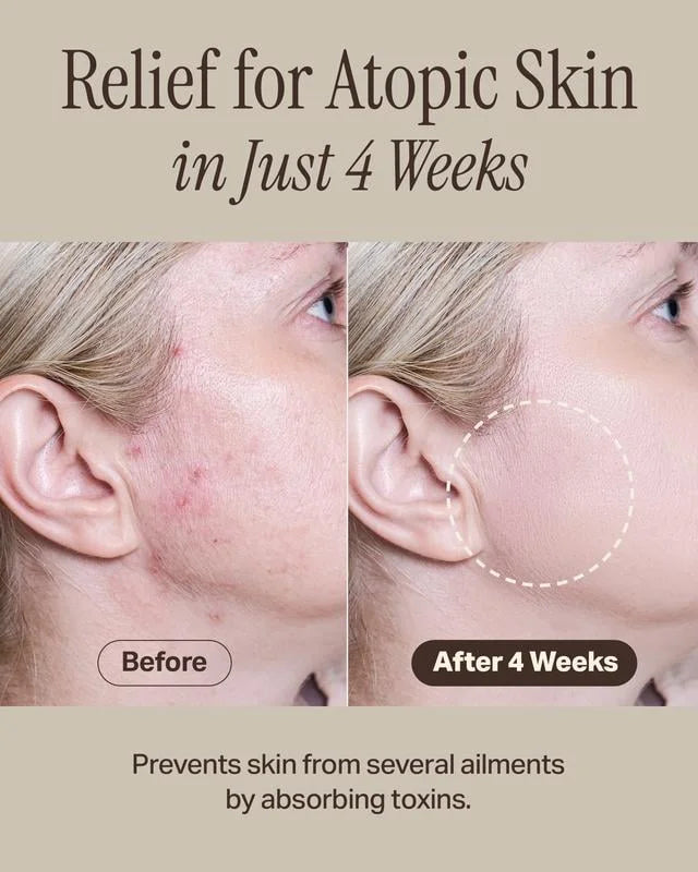 Relief Mud Mask – Deep Cleansing & Hydrating with Boryeong Mud