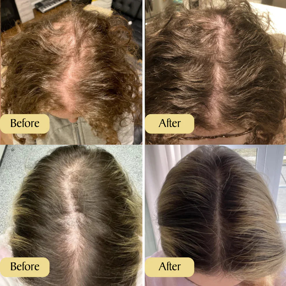 Spring Sale 49% OFF！ Natural Hair Growth Oil