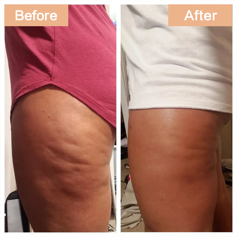 Anti-Cellulite Elixir
