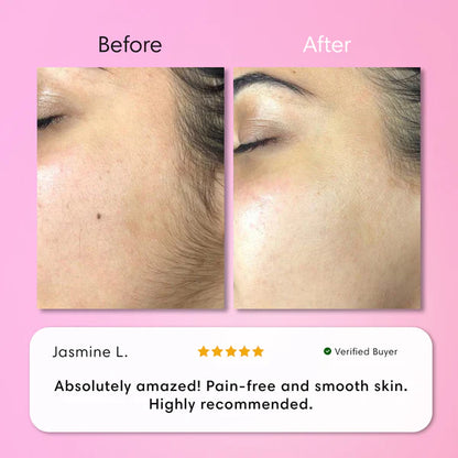 Hair Removal Kit