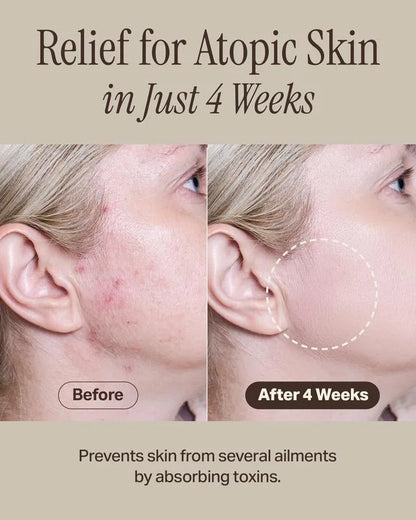 Relief Mud Mask – Deep Cleansing & Hydrating with Boryeong Mud