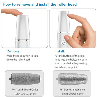 Last Day 49% OFF！Electric Feet Callus Remover