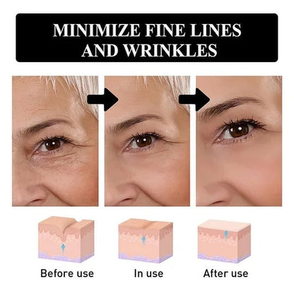 Hyaluronic Acid Anti-Wrinkle Repair Essence
