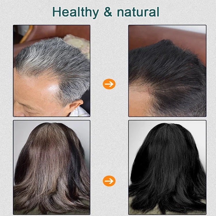 Natural Plant Hair Dye & BUY 5 GET 5 FREE & Free Shipping