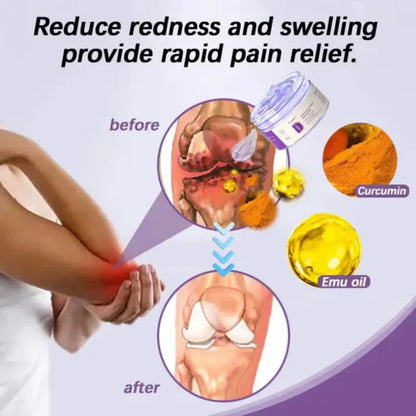 Curcumin & Emu Oil Pain Gel – 🏥Backed by US Osteopathic Experts