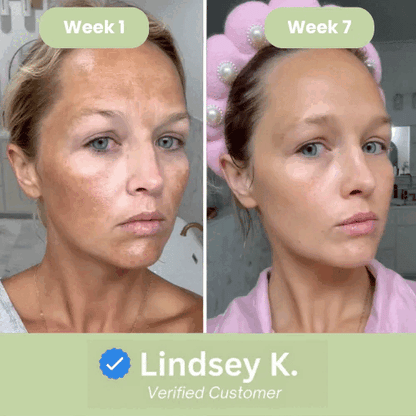 Korean Anti-Aging Toner Pads