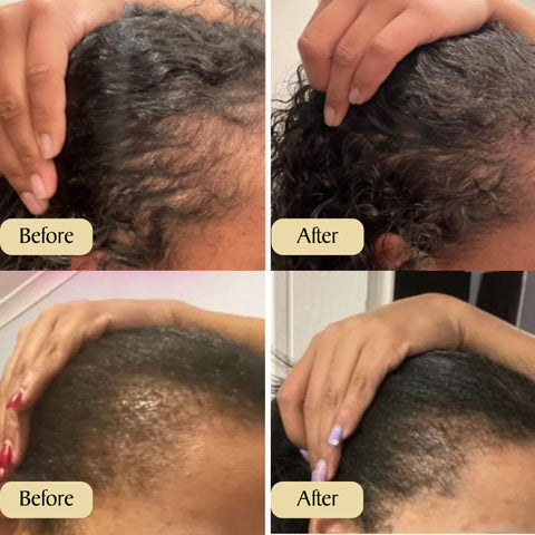 Spring Sale 49% OFF！ Natural Hair Growth Oil