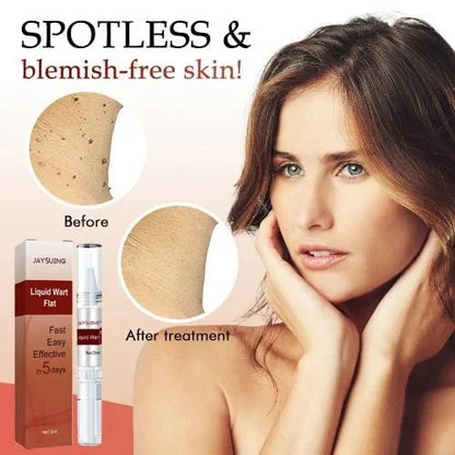 Best Sellers - Tags & Moles Remover——10 pcs (FREE SHIPPING)