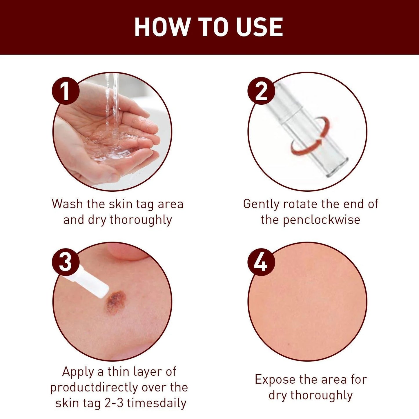 Best Sellers - Tags & Moles Remover——10 pcs (FREE SHIPPING)