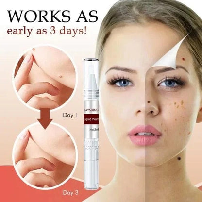 Best Sellers - Tags & Moles Remover——10 pcs (FREE SHIPPING)